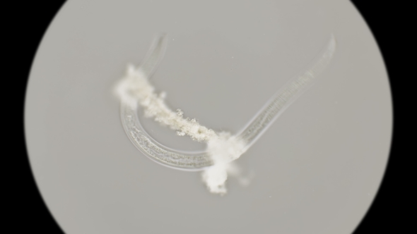 Nematode Worm Under a Microscope alt