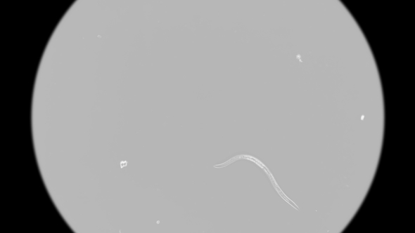 Nematode Worm Under a Microscope alt