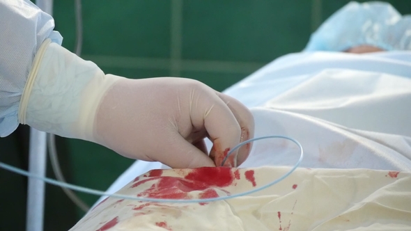 Surgeon in Uniform Inserts a Thin Pipe Into a Patient with a Bloody Spot
