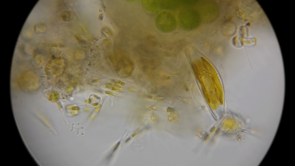 Diatoms and Microorganisms Under a Microscope alt
