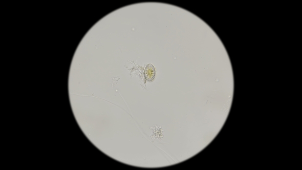 Diatom Algae in Fresh Water, Under a Microscope alt