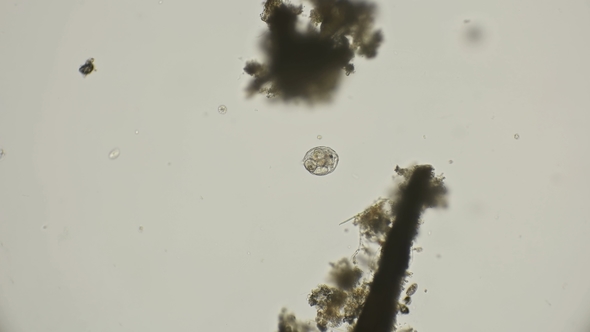 Rotifuge Cathypna Luna Under a Microscope alt