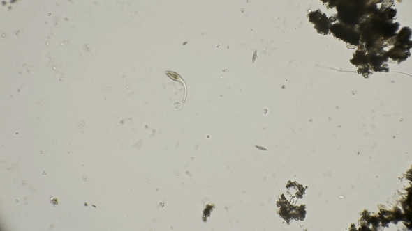 Infusoria Lacrimaria To Hunt and Quickly Moves Under a Microscope alt