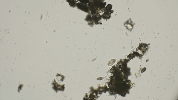 Infusoria Lacrimaria Hunts and Quickly Moves under a Microscope alt