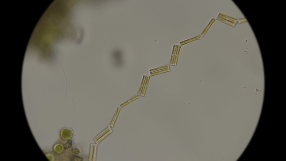 Diatoms Linked To Each Other Under a Microscope alt