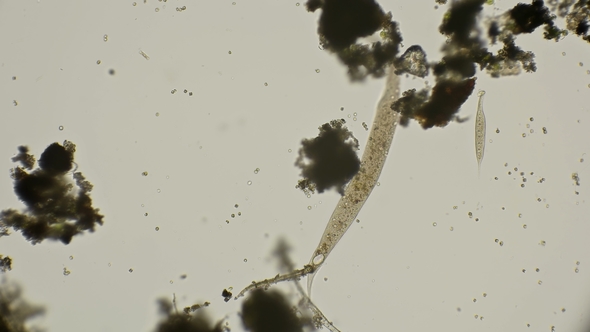 Dileptus in Search of Food under a Microscope alt