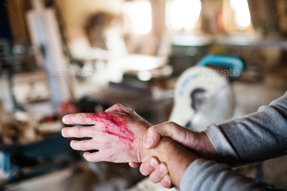 Man with an injured hand after accident at work in the carpentry workshop.
