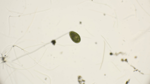 Rotation and Algae Dance Under the Microscope alt