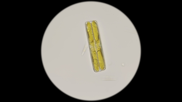 Diatom Algae in Fresh Water, Under a Microscope alt