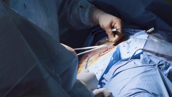 Hands of the Two Surgeons During Suturing