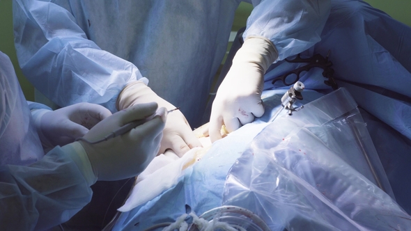 The Surgeon Making an Incision on the Abdomen