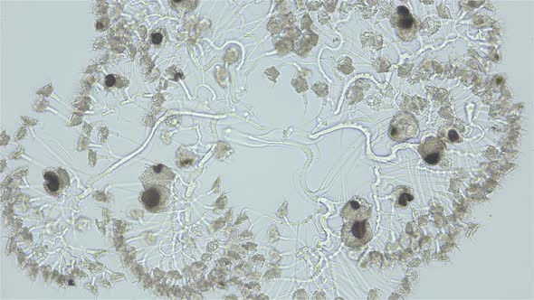 Infusoria (Ciliophora) Peritrichia under microscope, order Sessilida, class Oligohymenophorea alt