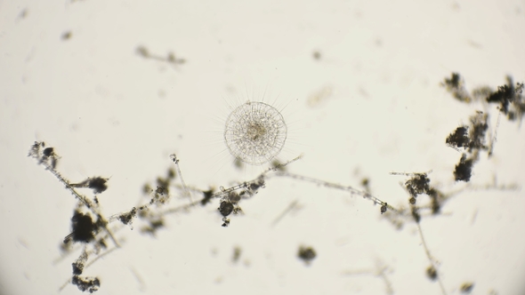 the Simplest Organisms of the Heliozoa Class, Similar To Radiolarians, Under a Microscope alt