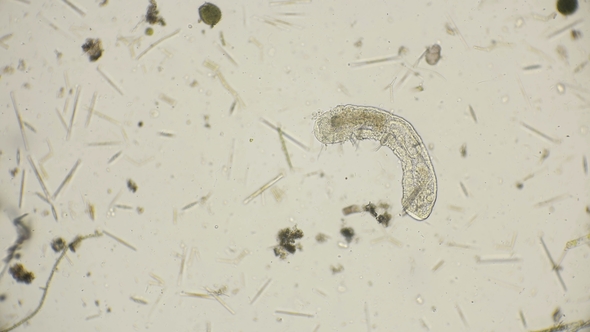 The Simplest Microorganism Worm under a Microscope alt