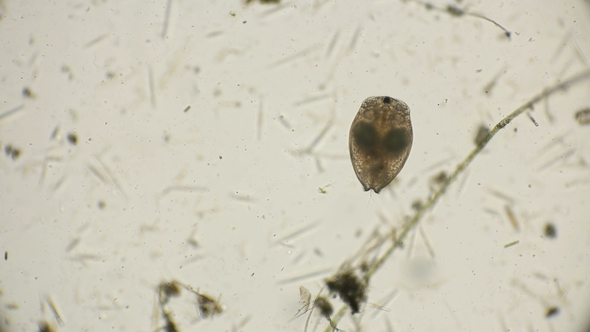 Bosmia Branchis with Microscope alt