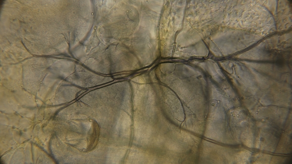 Structure of Internal Organs of the Larva Lesser Water Boatman Under a Microscope alt