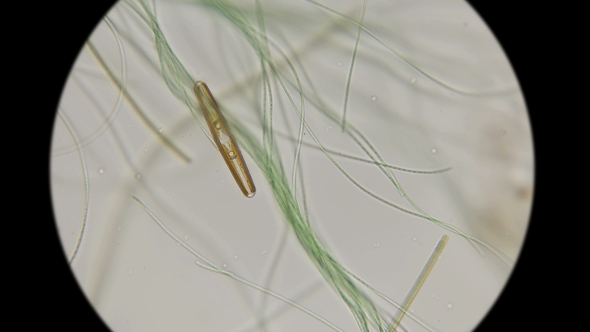the Movement of Diatom Alga Among Ordinary Live Algae Under a Microscope alt