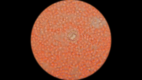 Infected Blood with a Corpse Wand in a Dead Mouse Under a Microscope alt