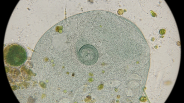 Buccal Cavity Infusorians Stentor Coeruleus Under a Microscope alt