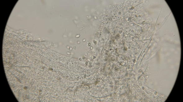 A Colony of Microorganisms That Multiplies and Consumes Worm Remains Under a Microscope alt