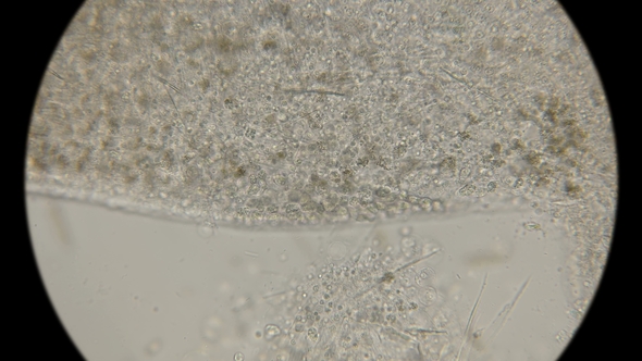 A Colony of Microorganisms That Multiplies and Consumes Worm Remains Under a Microscope alt