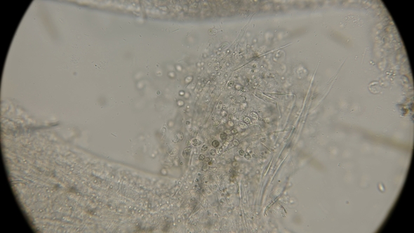 A Colony of Microorganisms That Multiplies and Consumes Worm Remains Under a Microscope alt