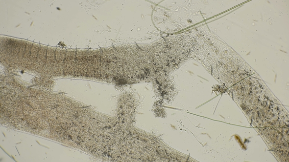 a Colony of Microorganisms That Multiplies and Consumes Worm Remains Under a Microscope alt