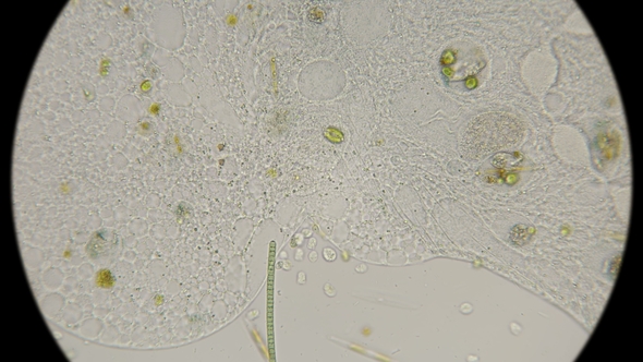 the Formation of Colonies of Microorganisms in a Dead Infusoria Under a Microscope alt