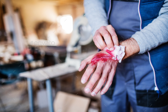 Man with an injured hand after accident at work in the carpentry workshop. Stock Photo by halfpoint