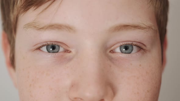 Teenager with Freckles on Face Spots on Skin Smiling and Looking in Camera