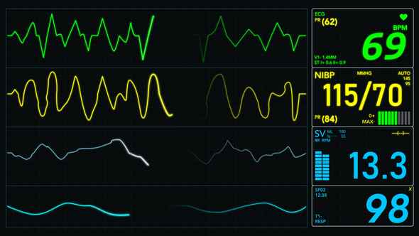EKG Monitor Screen