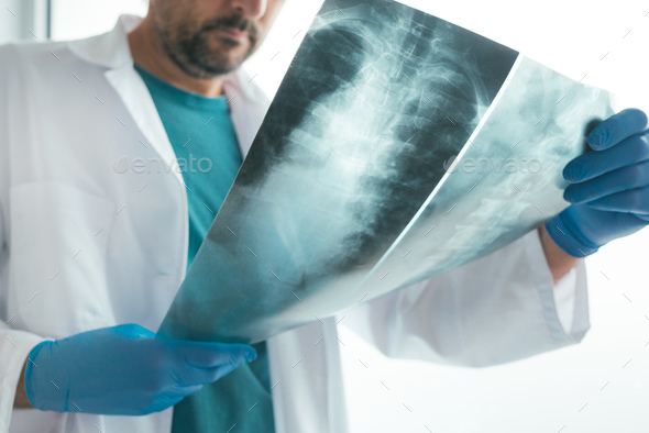 Doctor examining x-ray of the human spine - Stock Photo - Images