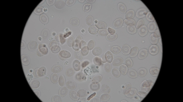 Blood of a Fish Under a Microscope alt