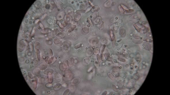 Blood of a Fish Under a Microscope alt