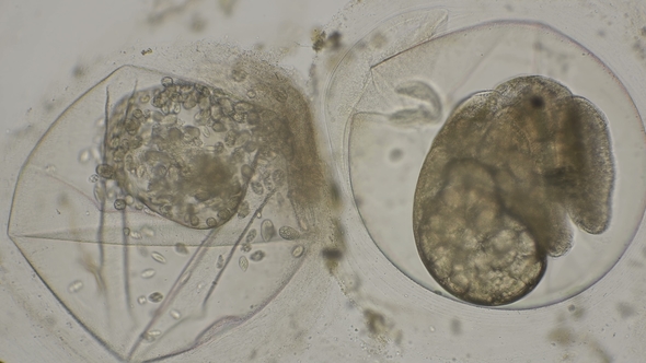 Eggs of Planorbis Snails with Already Developed Embryo and Dead Eggs, Infected with Infusoria alt