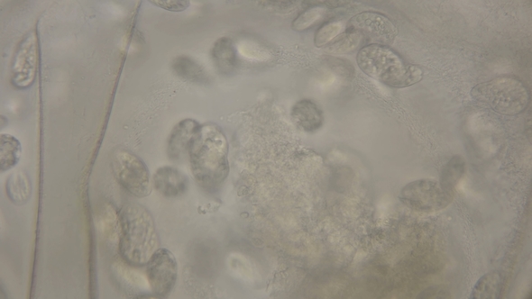 Colony of Ciliates Etrahymena Pyriformis Eating Snail Eggs and Being Parasites, Under a Microscope alt