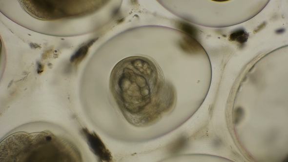 Moving the Eggs Snails Planorbis in Time Laps, Under a Microscope alt