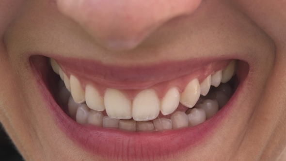 Woman's Mouth with Big Smile
