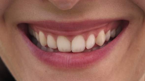 Mouth of Woman with Beautiful Lips and White Teeth Smiling Broadly