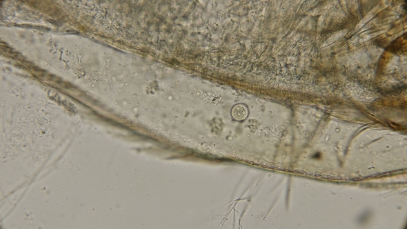 in the Body of Dead Daphnia Parasites Formed: Tetrahymena, Spirochetes and Others, Under a alt