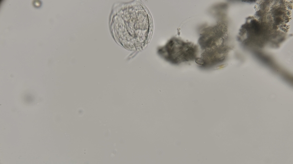 Armor Rotifer Lecane Under a Microscope alt