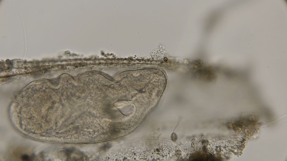 Ciliated Flat Worm Under a Microscope alt
