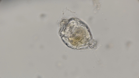 Hatching From the Egg of a Creeping Rotatoria Under a Microscope alt