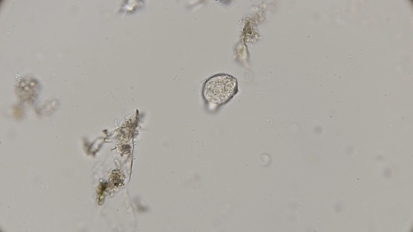 Hatching From the Egg of a Creeping Rotatoria Under a Microscope, Stock ...