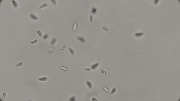 Colony of the Simplest Microorganisms Including Parasites Under a Microscope alt