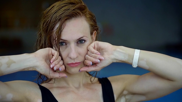 Shot of a Attractive Athletic Female Model with Vitiligo Posing By the Swimming Pool alt