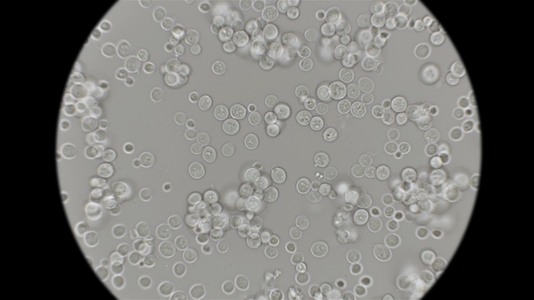 Yeast Is Moving Under the Microscope alt