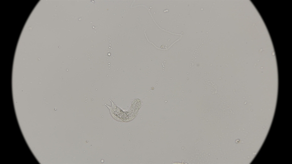 Brûhoresničnye Worms Gastrotricha Under the Microscope alt