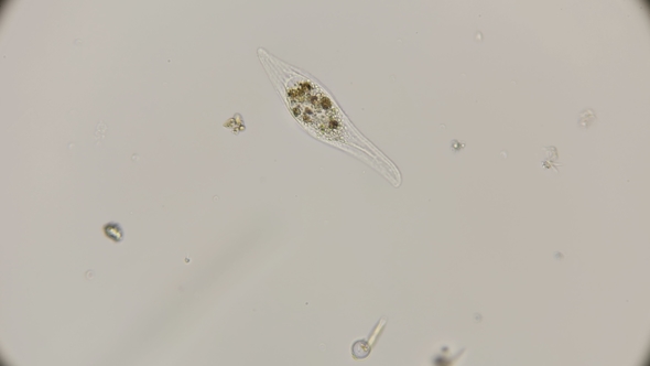 Amphileptus Infusoria in Motion Looking for Food, Under a Microscope alt