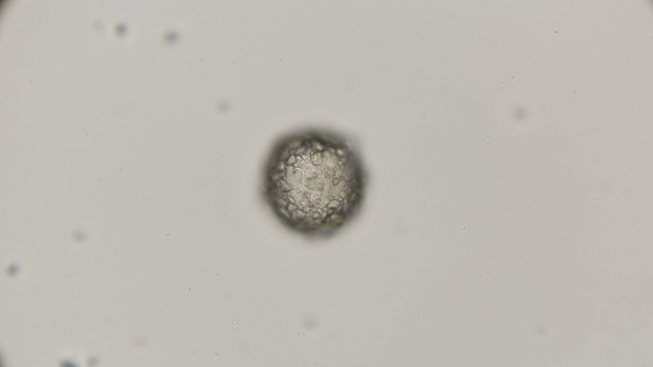 Shell of Testacea Amoeba Difflugia Class Lobostoma Top View of the Shell alt